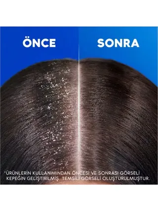 Head & Shoulders Klasik Bakım Kepek Karşıtı Günlük Kullanım 330ML Şampuan